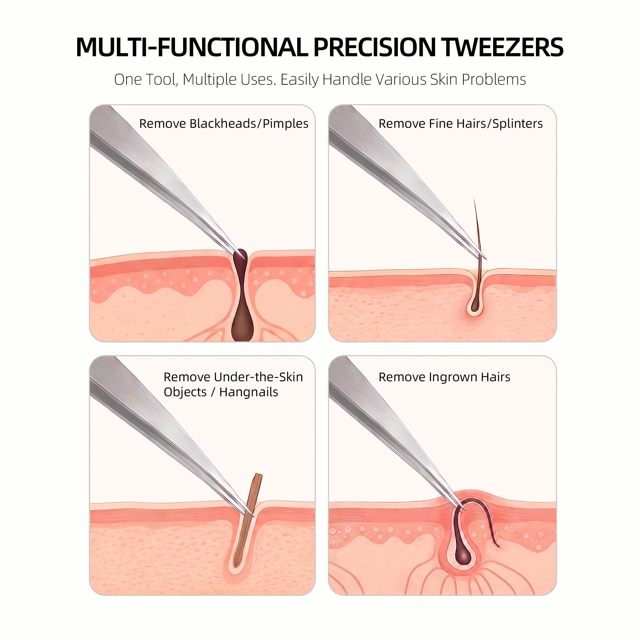 AUSOMTEK 96mm Ingrown Hair Tweezers with Needle Pointed Tip